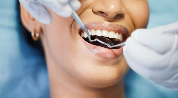 Best Emergency Denture Repair in Spinnerstown, PA